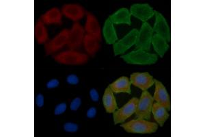 ABIN6258004 and ABIN6275034 staining Hela cells(30 min of UV treatment) by IF/ICC.