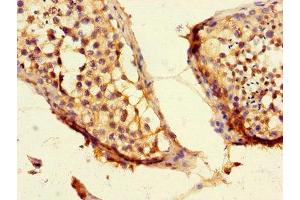 Immunohistochemistry of paraffin-embedded human testis tissue using ABIN7147399 at dilution of 1:100 (CEP192 anticorps  (AA 447-711))