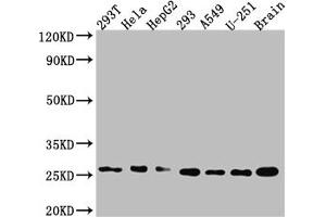 Western Blot Positive WB detected in: 293T whole cell lysate, Hela whole cell lysate, HepG2 whole cell lysate 293 whole cell lysate, A549 whole cell lysate, U-251 whole cell lysate, Mouse Brain whole cell lysate All lanes: Id1 antibody at 1:1000 Secondary Goat polyclonal to rabbit IgG at 1/50000 dilution Predicted band size: 17, 16 kDa Observed band size: 26 kDa