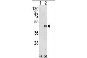 Western blot analysis of CEBPB (arrow) using rabbit polyclonal CEBPB Antibody (C-term) (ABIN652248 and ABIN2841040). (CEBPB anticorps  (C-Term))