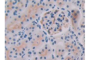 DAB staining on IHC-P; Samples: Rat Kidney Tissue