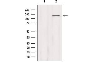 Western blot analysis of extracts from HepG2, using Phospho-Abl (Tyr204) Antibody.