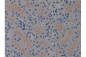 Detection of HMGN1 in Mouse Kidney Tissue using Polyclonal Antibody to High Mobility Group Nucleosome Binding Domain Protein 1 (HMGN1)