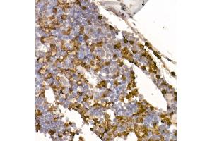 Immunohistochemistry of paraffin-embedded Mouse bone marrow using Neutrophil Elastase (ELANE) antibody (ABIN7266912) at dilution of 1:100 (40x lens).