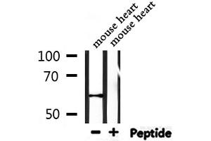 Western blot analysis of extracts from mouse heart, using WEE2 Antibody.