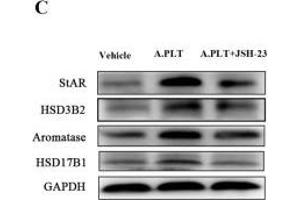 Effect of suppression of NF-κB activation by JSH-23 on the production of E2 and expression of steroidogenic genes in HESCs.