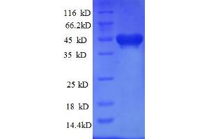 SDS-PAGE (SDS) image for Kinesin Family Member 1C (KIF1C) (AA 1-272) protein (His-SUMO Tag) (ABIN5709805)