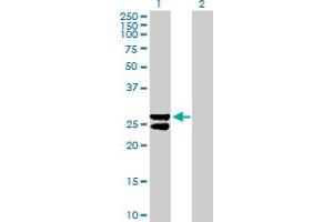 Western Blot analysis of MMAB expression in transfected 293T cell line by MMAB MaxPab polyclonal antibody. (MMAB anticorps  (AA 1-250))