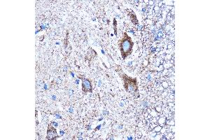 Immunohistochemistry of paraffin-embedded Mouse spinal cord using CTGF Rabbit pAb (ABIN6127717, ABIN6139188, ABIN6139191 and ABIN6215222) at dilution of 1:100 (40x lens). (CTGF anticorps  (AA 27-349))