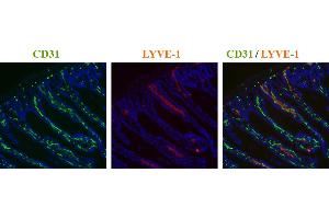 Immunohistochemistry detection of endogenous LYVE-1 in cryo sections of mouse colon carcinoma using anti-LYVE-1 (mouse), pAb  (red) and anti-mouse CD31 pAb (green). (LYVE1 anticorps  (AA 24-228))