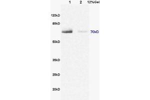 L1 rat brain lysates L2 rat heart lysates probed with Anti DENTT Polyclonal Antibody, Unconjugated (ABIN722245) at 1:200 in 4 °C.
