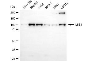 Western blotting analysis using MIB1 antibody (ABIN7799413).
