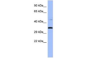 WB Suggested Anti-PYCR1  Antibody Titration: 0. (PYCR1 anticorps  (Middle Region))
