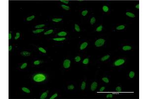 Immunofluorescence of monoclonal antibody to CMAS on HeLa cell. (CMAS anticorps  (AA 164-263))