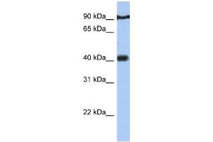 Western Blotting (WB) image for anti-Prostate Tumor Overexpressed 1 (PTOV1) antibody (ABIN2459436)