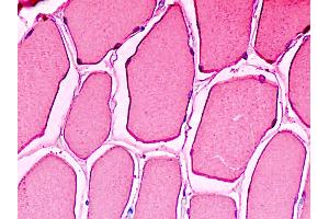 Anti-MB / Myoglobin antibody IHC staining of human skeletal muscle. (Myoglobin anticorps)