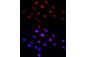 Immunofluorescence analysis of U2OS cells using LEO1 Rabbit pAb (ABIN6133790, ABIN6143141 and ABIN7101832) at dilution of 1:50 (40x lens).