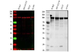 Western blot analysis of MSH2 using anti-MSH2 antibody (ABIN3043885). (MSH2 anticorps  (AA 337-583))