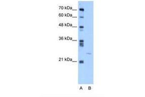 Image no. 1 for anti-YEATS Domain Containing 4 (C-Term) antibody (ABIN324207) (GAS41 anticorps  (C-Term))