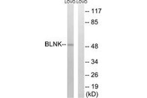 Western blot analysis of extracts from LOVO cells, treated with etoposide 25uM 24h, using BLNK (Ab-96) Antibody. (B-Cell Linker anticorps  (AA 62-111))