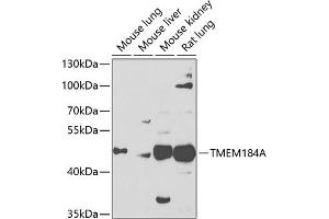 Western blot analysis of extracts of various cell lines, using TMEM184A antibody (ABIN6128873, ABIN6149260, ABIN6149261 and ABIN6223833) at 1:1000 dilution. (TMEM184A anticorps  (AA 324-413))