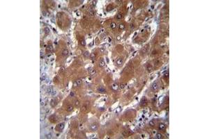 Immunohistochemistry analysis in formalin fixed and paraffin embedded human liver tissue reacted with Cytosolic beta-glucosidase Antibody (C-term) followed by peroxidase conjugation of the secondary antibody and DAB staining.