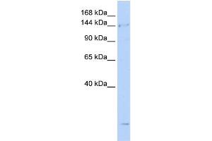 WB Suggested Anti-SMC4 Antibody Titration:  0. (SMC4 anticorps  (N-Term))