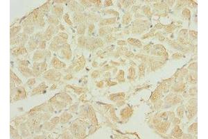 Immunohistochemistry of paraffin-embedded human heart tissue using ABIN7169200 at dilution of 1:100
