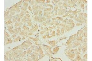 Immunohistochemistry of paraffin-embedded human heart tissue using ABIN7169200 at dilution of 1:100 (TNNI3K anticorps  (AA 1-75))