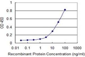 Detection limit for recombinant GST tagged TAGLN is 0.