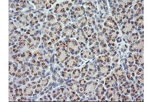 Image no. 1 for anti-Cancer/testis Antigen 1B (CTAG1B) antibody (ABIN1499891) (CTAG1B anticorps)