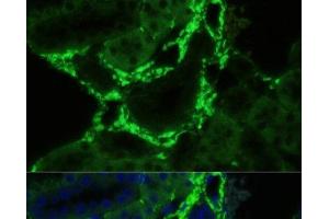 Immunofluorescence analysis of Mouse kidney using COL1A1 Polyclonal Antibody at dilution of 1:100. (COL1A1 anticorps)