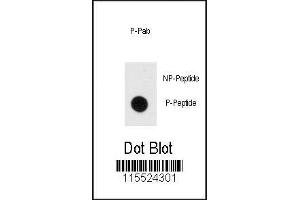 Dot blot analysis of phospho-MBP antibody.