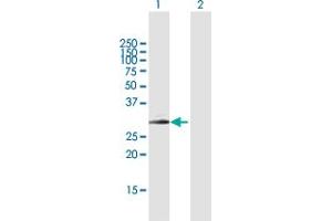 Western Blot analysis of SPINT2 expression in transfected 293T cell line by SPINT2 MaxPab polyclonal antibody.