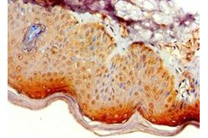 Immunohistochemistry of paraffin-embedded human skin tissue using ABIN7145338 at dilution of 1:100 (ATG14 anticorps  (AA 1-310))