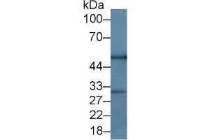 Mouse Capture antibody from the kit in WB with Positive Control: Rat Thymus Tissue.