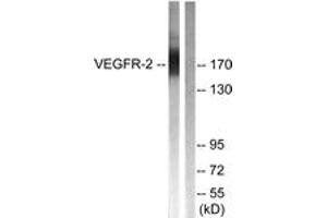 Western blot analysis of extracts from HepG2 cells, treated with Na3VO4 0. (VEGFR2/CD309 anticorps  (AA 1025-1074))
