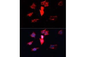 Immunofluorescence analysis of HeLa cells using C antibody (ABIN3021589, ABIN3021590, ABIN3021591 and ABIN6215299) at dilution of 1:100.
