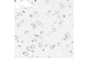 Immunohistochemistry of paraffin-embedded rat brain using RNF149 antibody (ABIN7270062) at dilution of 1:100 (40x lens). (RNF149 anticorps  (AA 221-400))