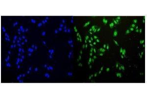 anti-NDC80 Kinetochore Complex Component Homolog (NDC80) (AA 87-602) antibody