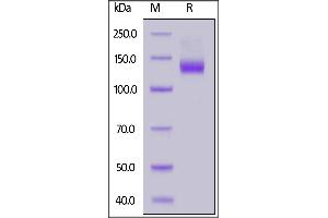 Human ACE2, Mouse IgG1 Fc Tag on  under reducing (R) condition.