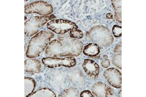 Immunohistochemical staining (Formalin-fixed paraffin-embedded sections) of human kidney with CA12 monoclonal antibody, clone CL0278  shows strong membranous immunoreactivity in renal tubules, but not glomeruli. (CA12 anticorps)