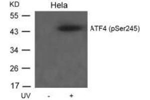 Western blot analysis of extracts from Hela cells untreated or treated with UV using ATF4(Phospho-Ser245) Antibody. (ATF4 anticorps  (pSer245))
