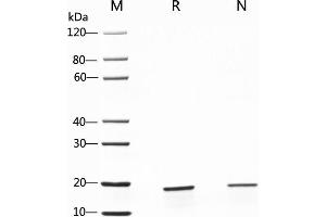 Fibroblast Growth Factor 2 (Basic) (FGF2) (AA 135-288), (Isoform 1) (Active) protein