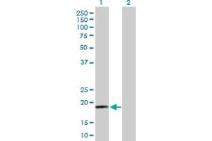 Western Blot analysis of RPS19 expression in transfected 293T cell line by RPS19 MaxPab polyclonal antibody.