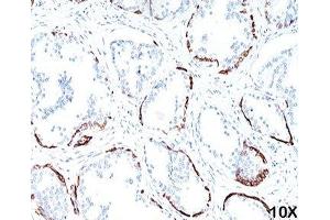 IHC staining of human prostate (10X) with HMW Cytokeratin antibody (34bE12). (KRT1 anticorps)