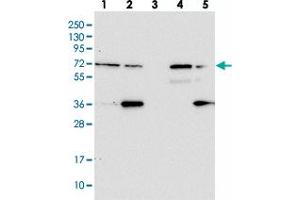 Western blot analysis of Lane 1: RT-4, Lane 2: U-251 MG, Lane 3: Human Plasma, Lane 4: Liver, Lane 5: Tonsil with ZNF609 polyclonal antibody  at 1:100-1:250 dilution. (ZNF609 anticorps)