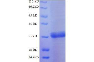 SDS-PAGE (SDS) image for Trehalase (Brush-Border Membrane Glycoprotein) (TREH) (AA 546-751), (partial) protein (His tag) (ABIN5713136)