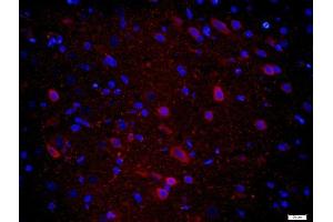 Paraformaldehyde-fixed, paraffin embedded rat brain tissue, Antigen retrieval by boiling in sodium citrate buffer(pH6) for 15min, Block endogenous peroxidase by 3% hydrogen peroxide for 30 minutes, Blocking buffer (normal goat serum) at 37°C for 20min, Antibody incubation with Rabbit Anti-CPLX1 Polyclonal Antibody, Unconjugated  at 1:400 overnight at 4°C, followed by a conjugated secondary and DAPI staining
