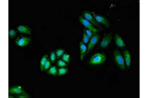 Immunofluorescent analysis of HepG2 cells using ABIN7154420 at dilution of 1:100 and Alexa Fluor 488-congugated AffiniPure Goat Anti-Rabbit IgG(H+L)